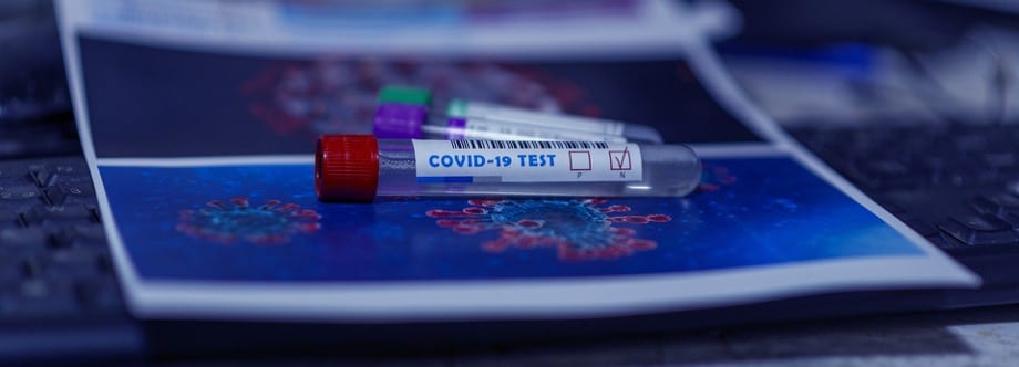 3 Steps to Get Ready for Flu Season in a COVID-19 Society, testing blood test